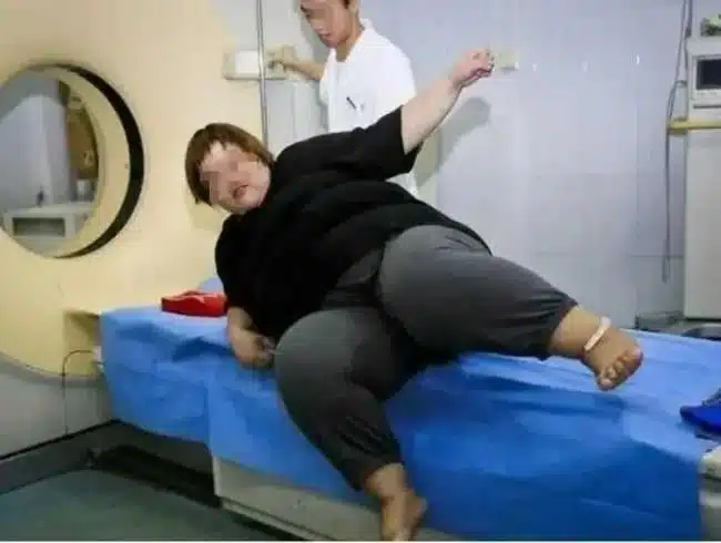 พานเสี่ยวถิงเคยกินจุจนเลือดออกในกระเพาะอาหาร ต้องนอนรักษาตัวโรงพยาบาล