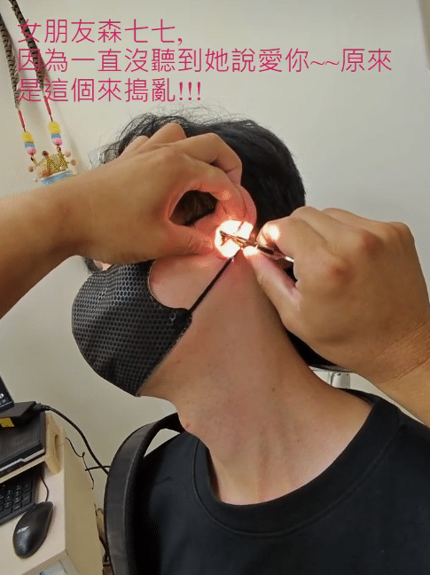 หมอเฉินใช้แหนบคีบขี้หูยาว 4 เซนติเมตรออกมาโดยใช้เวลาประมาณ 40 วินาที