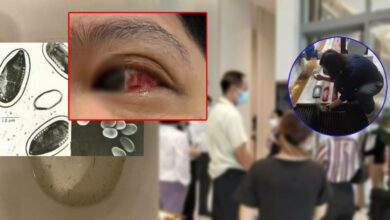 ปรสิตคอนโดลาดพร้าว