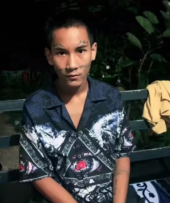 คลินิกช่วยหนุ่ม 16 ลบรอยสักฟรี