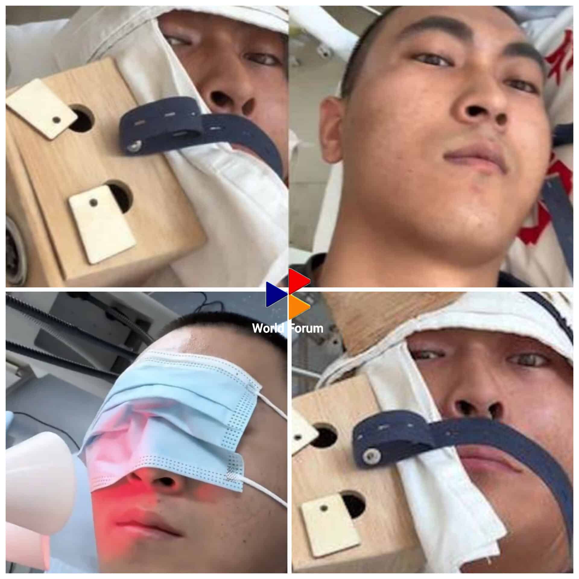 หนุ่มจีนป่วยเป็นอัมพาตใบหน้า