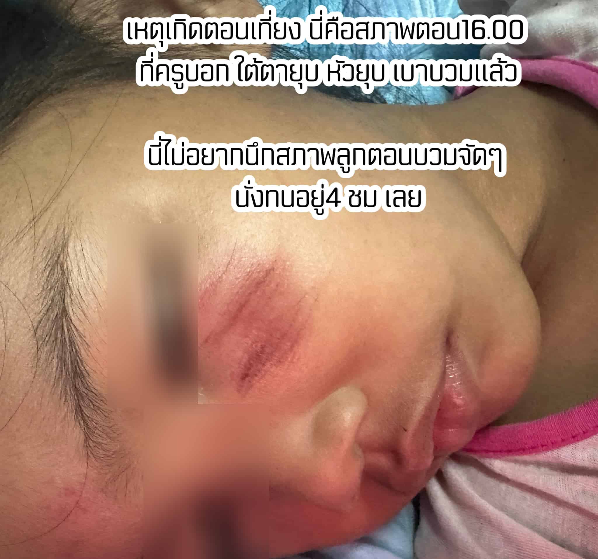 เด็กหญิง 4 ขวบ หน้าบูด-ตาปิด ถามคุณครู อ้างไม่รู้เรื่องเกิดอะไรขึ้น-1