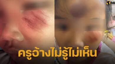 เด็กหญิง 4 ขวบ หน้าบูด-ตาปิด ถามคุณครู อ้างไม่รู้เรื่องเกิดอะไรขึ้น-5