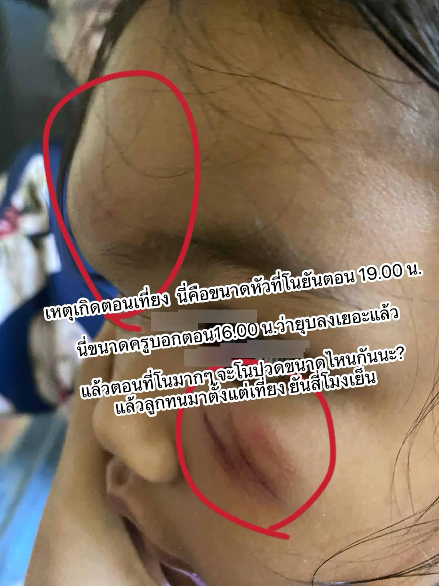 เด็กหญิง 4 ขวบ หน้าบูด-ตาปิด ถามคุณครู อ้างไม่รู้เรื่องเกิดอะไรขึ้น