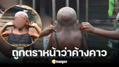 ้น่าเห็นใจ เด็กหญิง 9 ขวบ ถูกตั้งฉายา &#039;ค้างคาว&#039; เพราะร่างกายมีรูปร่างแปลก
