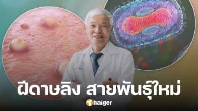 'หมอยง' เตือน 'ฝีดาษลิง' สายพันธุ์ใหม่ที่ต้องระวังในไทย ติดง่าย-อาการรุนแรง