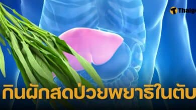 กินผักสด ป่วยพยาธิในตับ