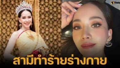 น้ำฝน เพชรปวีณ์ หิรัญกุลชัชวาล เล่าชีวิตถูกสามีไฮโซทำร้ายร่างกาย