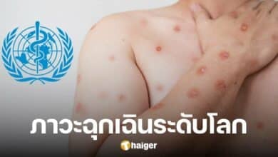 ด่วน อนามัยโลก ประกาศให้ 'ฝีดาษลิง' ในแอฟริกา เป็นภาวะฉุกเฉินระดับโลก