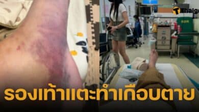 ล้มเพราะรองเท้าแตะจนขาหัก