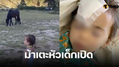 ม้าเตะหัวเด็กเปืด