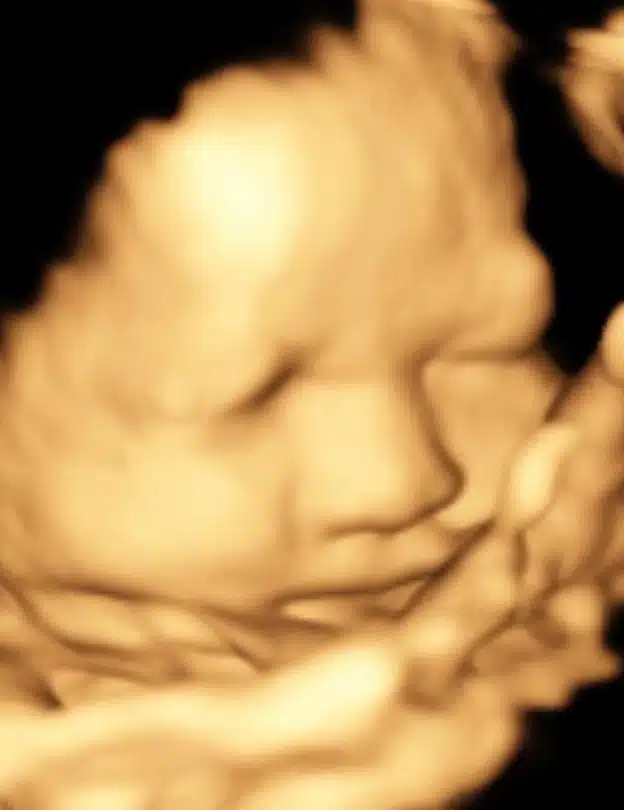 ภาพอัลตราซาวน์ลูกสาวปิงลี่ เฟมัส