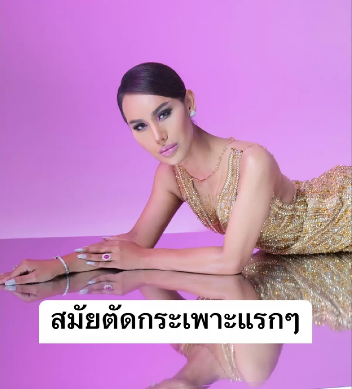 แอนนา หลังผ่าตัดกระเพาะใหม่ๆ