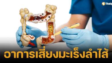 6 สัญญาณเตือน อาการสุ่มเสี่ยงของมะเร็งลำไส้ใหญ่ที่แพทย์แนะนำ มักพบในกลุ่มคนวัยหนุ่มสาวส่วนมากมักไม่รู้ตัวจนโรคลุกลามไปไกล