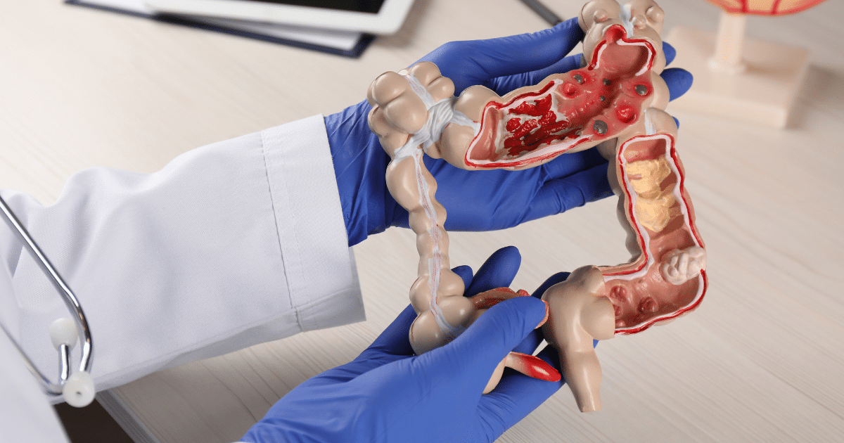 การตรวจพบมะเร็งในระยะเริ่มต้นนั้นมีความสำคัญ โดยการตรวจคัดกรองหรือแจ้งเตือนอาการบางอย่างเหล่านี้ เพื่อให้เราสามารถวินิจฉัยมะเร็งได้ตั้งแต่เนิ่นๆ ซึ่งสามารถรักษาให้หายได้ในที่สุด” ดร. เชคคินีกล่าวว่า “ยังคงรักษาผู้ป่วยมะเร็งส่วนใหญ่ได้ทุกปี