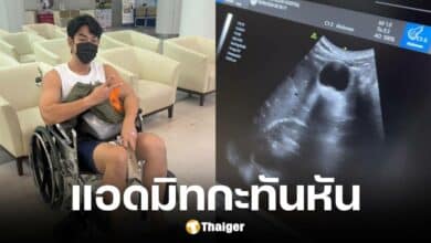 อาร์ต พศุตม์ ปวดท้องนาน 4 ชม. เข้า รพ. กลางดึก