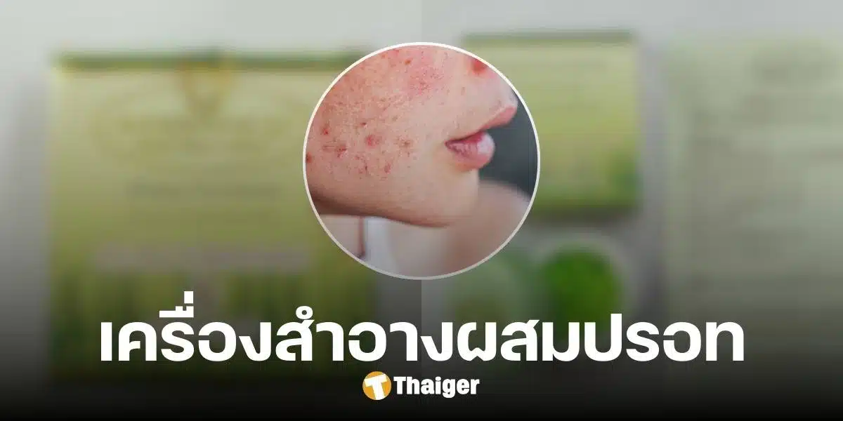 ระวังหน้าพัง อย. ตรวจพบ 'ปรอท' ในเครื่องสำอางดังบนออนไลน์ เตรียมดำเนินคดี