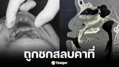 ลุงร้องเพจดัง ถูกกลุ่มไบเกอร์ชกหน้า เตะจนกรามหัก