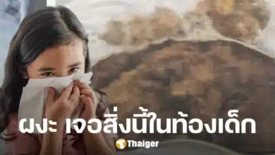 ช็อก เด็กหญิงเวียดนามป่วยหนัก หมอผ่าตัดเจอ 'ก้อนผม' ยักษ์ในท้อง เข้าไปได้ยังไง?
