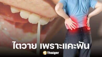 อุทาหรณ์ ชายป่วยไตวาย จากการแคะฟัน หมอเฉลย เพราะใช้ 'สิ่งนี้' แทนไม้จิ้มฟัน