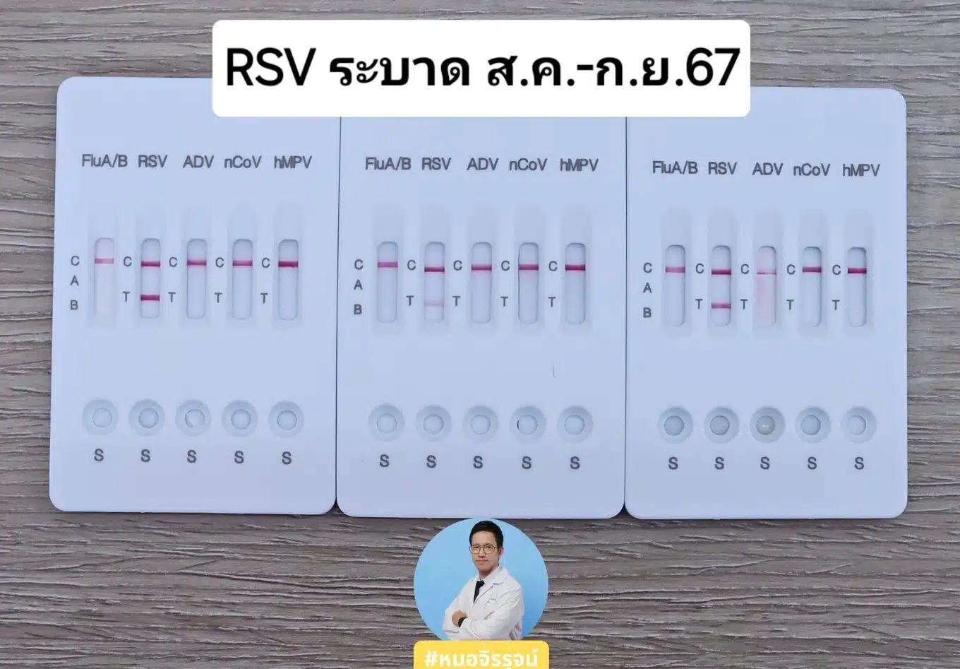 RSV ระบาด ส.ค.-ก.ย. 67 หมอจิรรุจน์