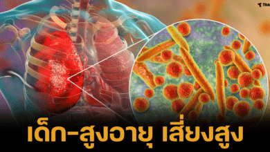 เตือนภัยปอดอักเสปภาคอีสาน เด็กและผู้สูงอายุ เสี่ยงสูง