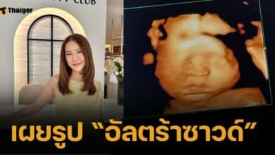 ยิ้มกรุบ "เบลล์ มนัญญา" เผยรูป อัลตร้าซาวด์ลูกน้อย แย้มอีกไม่นานก็ได้เจอแล้ว