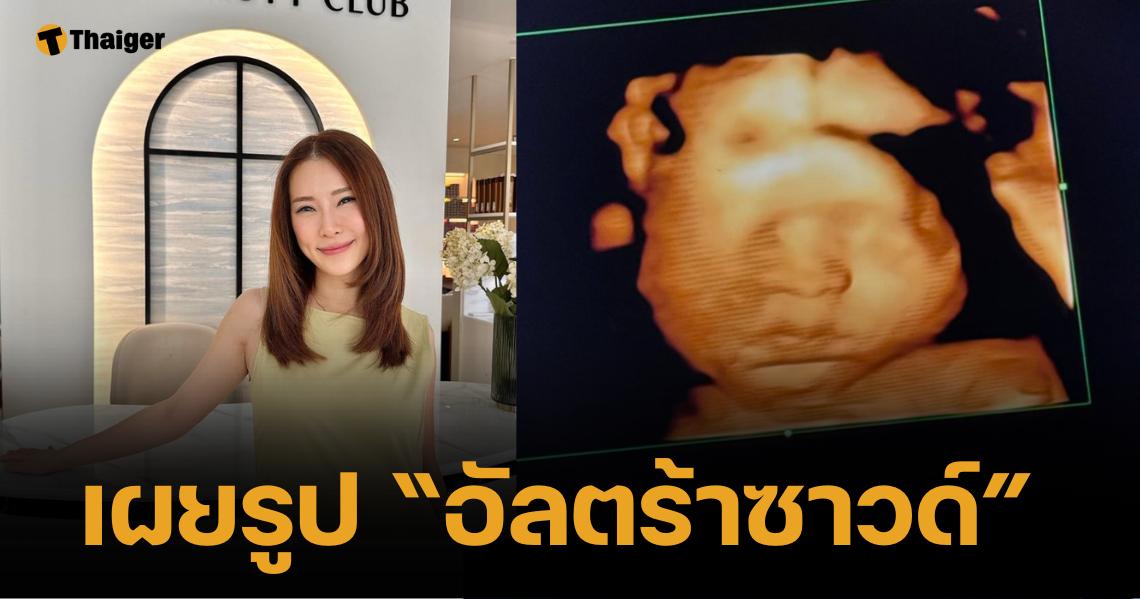 ยิ้มกรุบ "เบลล์ มนัญญา" เผยรูป อัลตร้าซาวด์ลูกน้อย แย้มอีกไม่นานก็ได้เจอแล้ว