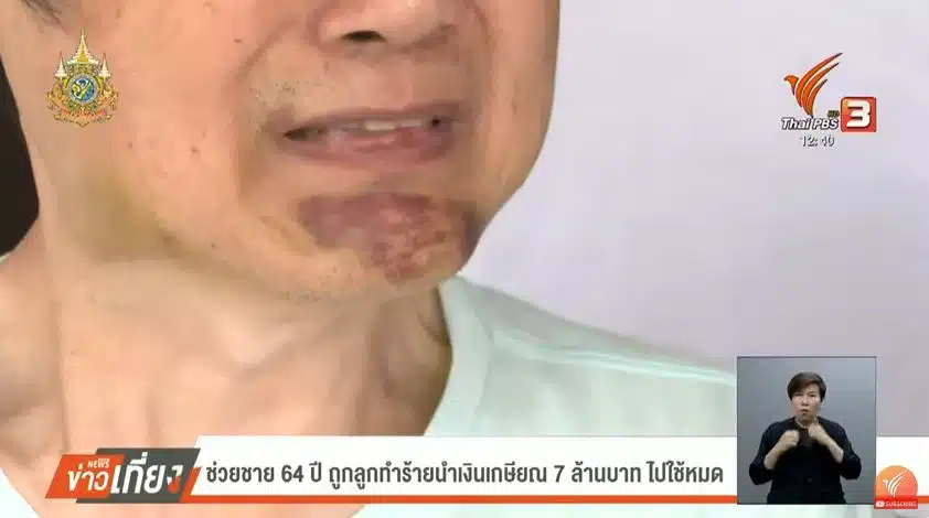 ลุงอำพล พ่อถูกลูกชายทำร้าย