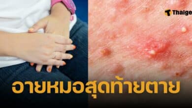 มีสิวขึ้นที่อวัยวะเพศ