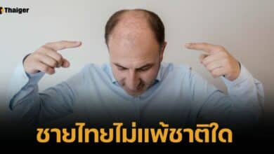 เอาเรื่อง! ชายไทยหัวล้านเยอะอันดับ 1 ในอาเซียน แซงมาเลฯฉิวเฉียด