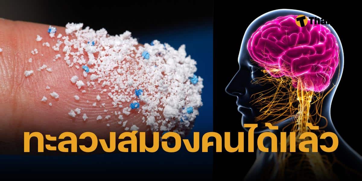 พบไมโครพลาสติกในสมองมนุษย์