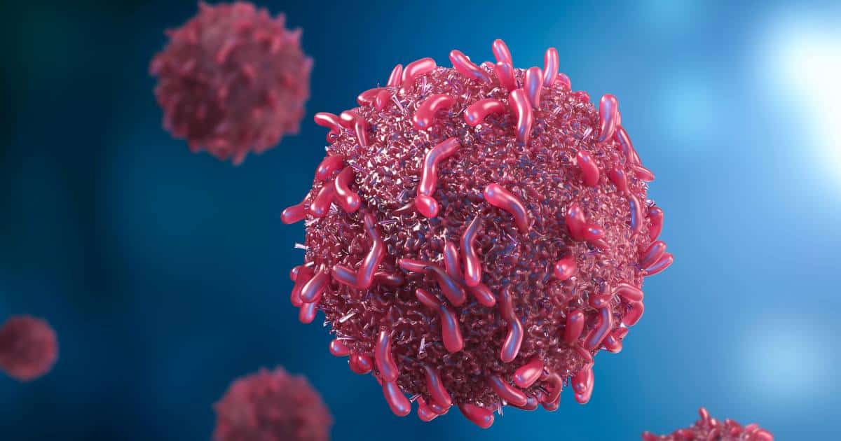 ดร.เหงียน ฮอง นุง เตือนว่า มะเร็งลิ้น เป็นหนึ่งในมะเร็งช่องปากที่พบได้บ่อย และอันตรายถึงชีวิตหากตรวจพบช้า มะเร็งชนิดนี้มักเริ่มต้นจากเซลล์ปกติที่บุผิวลิ้นเกิดการเปลี่ยนแปลงกลายเป็นเซลล์มะเร็ง ซึ่งสามารถลุกลามไปยังส่วนอื่นๆ ของช่องปากและลำคอได้อย่างรวดเร็ว