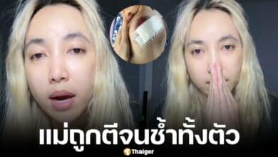 เฟิร์สแม่น้องแฟร์รี่ ร้องโซเชียล แม่ถูกเพื่อนบ้านทำร้ายร่างกาย ตีด้วยกระทะ มีรอยช้ำทั้งตัว