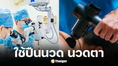 ชายชาวจีนใช้ปืนนวด นวดดวงตา สุดท้ายเป็นต้อกระจกและเลนส์ตาเคลื่อน