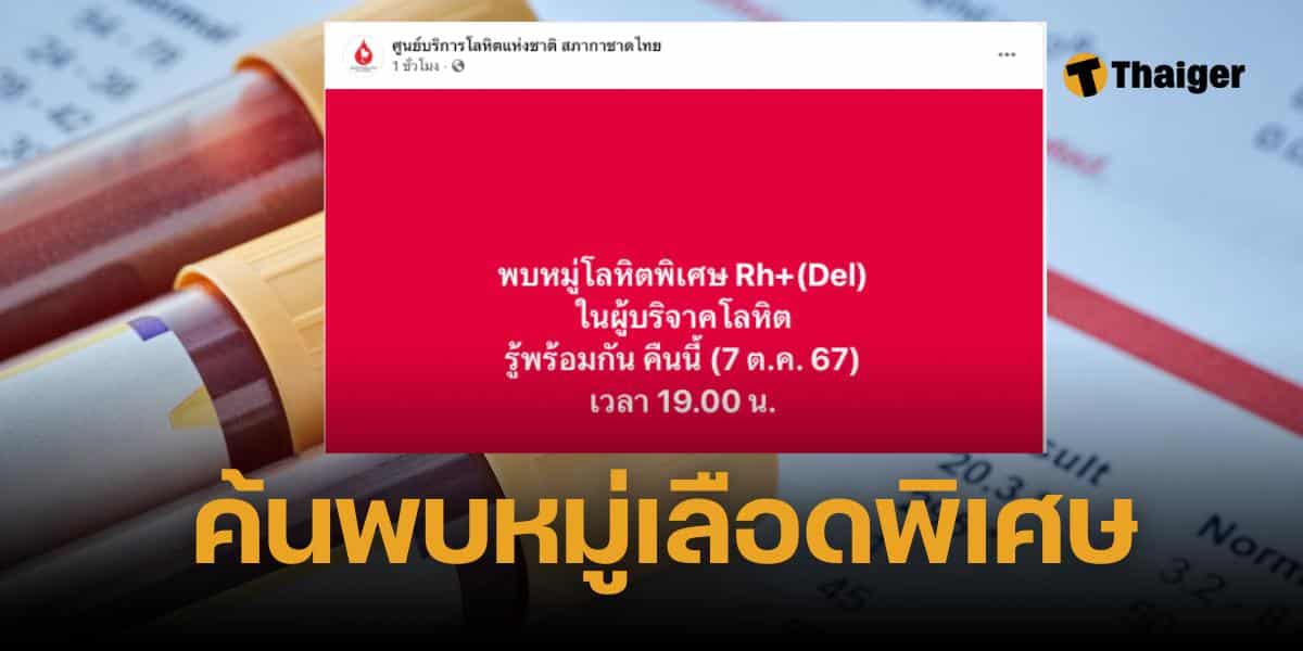 หมู่โลหิตพิเศษ Rh+ (Del)