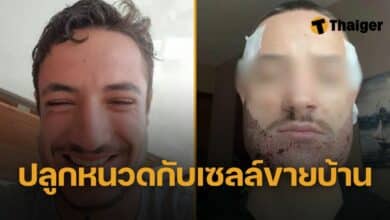 หลอกปลูหนวดกับหมอเถื่อน