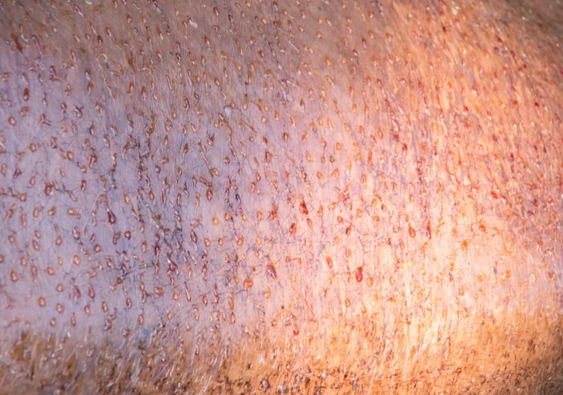 ฮิปโปโปเตมัส มีเหงื่อสีแดง