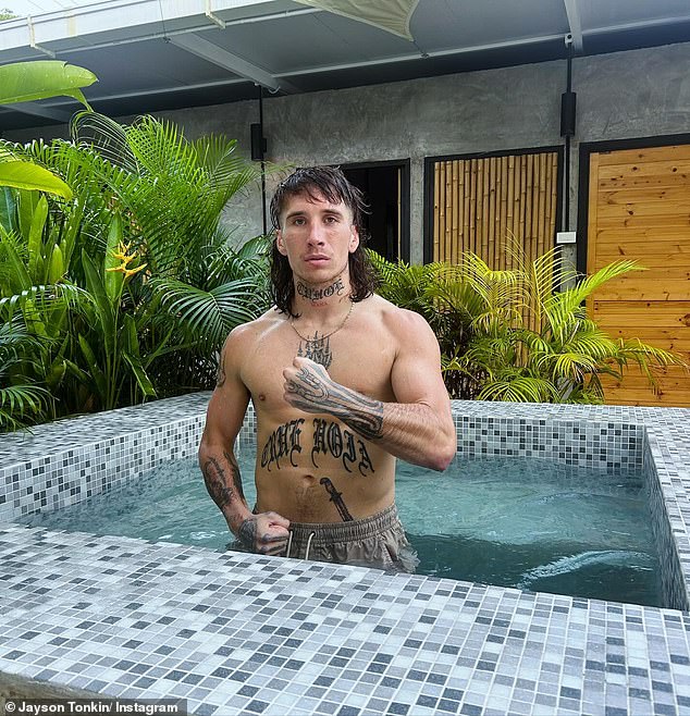 เจย์สัน ทอนกิน นอนอาการโคม่า 