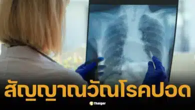 หญิงวัย 34 ไอเป็นเลือดวันเดียว แพทย์ตรวจพบวัณโรค เคราะห์ดีรักษาทัน