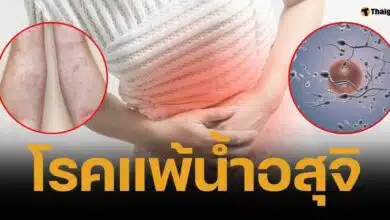 คู่รักไต้หวัน สุดซวย เมียแพ้น้ำอสุจิ แพทย์ชี้อยากมีลูกต้องผสมเทียม