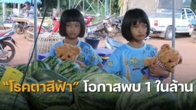 น้องกิ๊ฟ น้องแก้ม ฝาแฝดตาสีฟ้า