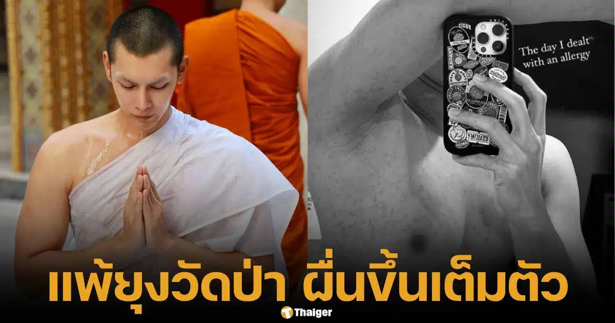 มิว ศุภศิษฏ์ แพ้ยุงวัดป่า สึกแล้วเล่าเรื่องตอนบวช ศีลห้ามฆ่าสัตว์ ภาวนาให้จิ้งจกช่วย