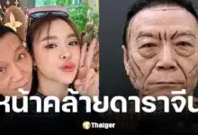 ซานิควงคุณพ่อศัลยกรรม เผยโฉมหลัง 1 เดือน