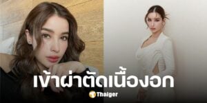 วิว วรรณรท ผ่าตัดเนื้องอก เผยอาการล่าสุด ผ่านไปด้วยดี จากนี้พักฟื้นยาว ๆ