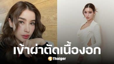 วิว วรรณรท ผ่าตัดเนื้องอก เผยอาการล่าสุด ผ่านไปด้วยดี จากนี้พักฟื้นยาว ๆ