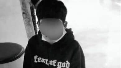 น้องโชกุน เสียชีวิต