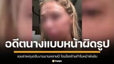 อดีตนางแบบชื่อดัง ใช้เงินล้านรักษาใบหน้าผิดรูป สุดท้าย พบปรสิตชนิดใหม่ที่ไม่เคยรู้จักมาก่อน ทำใบหน้าพังหนัก ต้องงดรับงานนานนับปีเพื่อรักษาตัว