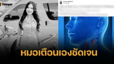 ผิง ชญาดา หมอเตือน อันตรายนวดบิดคอ เสี่ยงอัมพาต เส้นเลือดเลี้ยงสมองเสียหาย