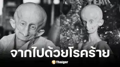 บรีนดริ บูเซ่น เสียชีวิตในวัย 19 ปี ด้วยโรคแก่ก่อนวัย